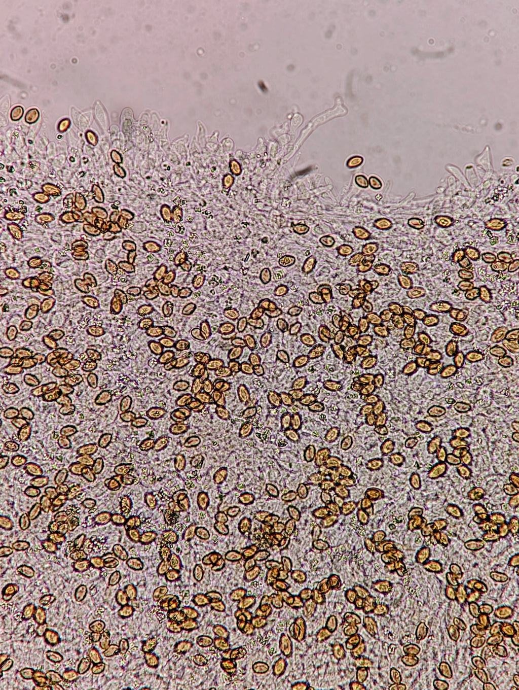 Ps. mescaleroensis Agar Culture