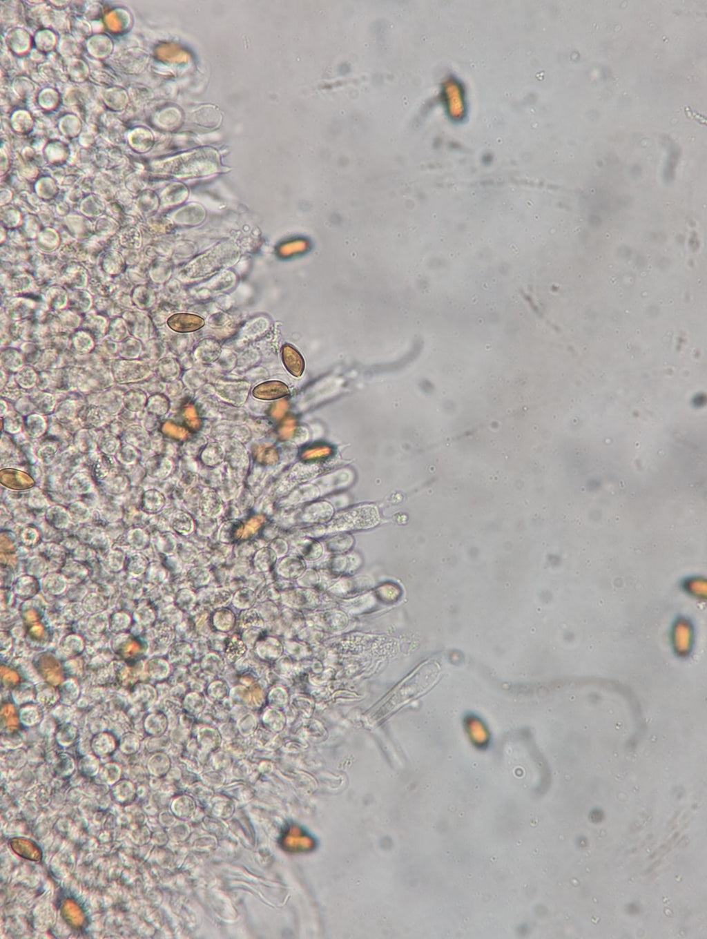 Ps. subaeruginosa, Melbourne, AU Spore Swab Set