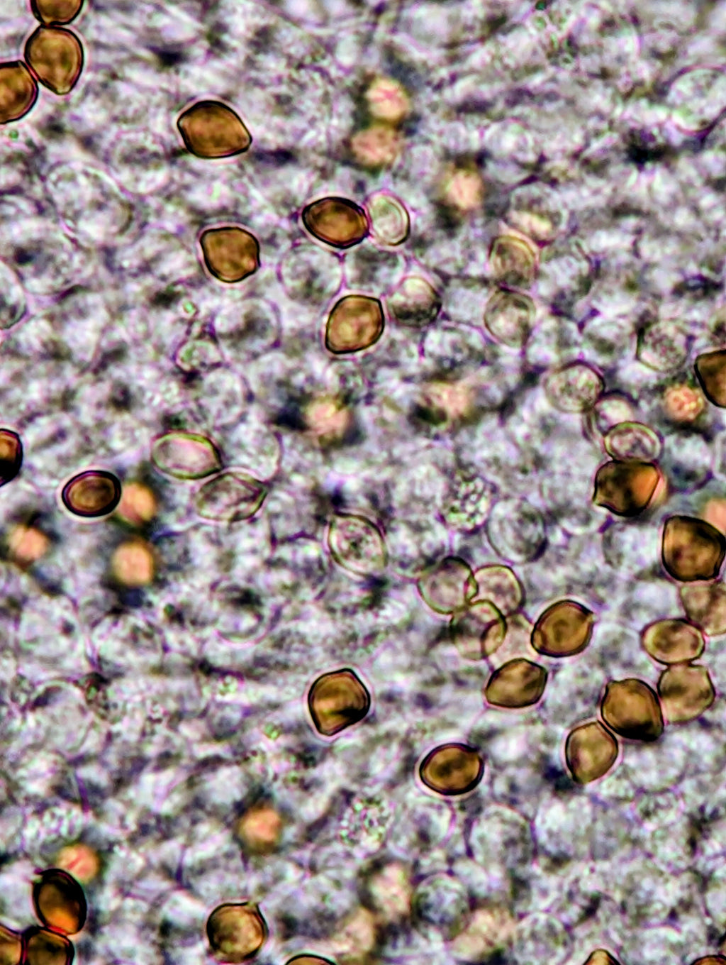 Ps. xgriseocaerulea Agar Culture