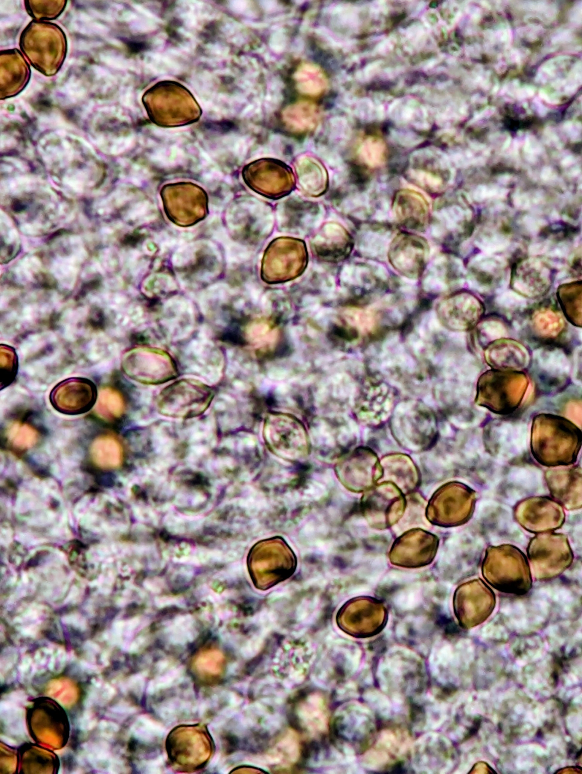 Ps. xgriseocaerulea Swab Set