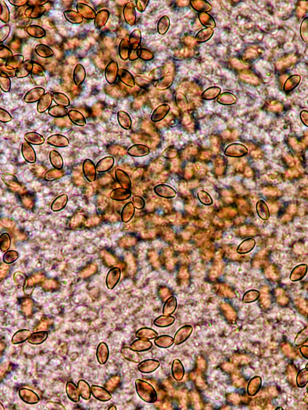 Ps. caerulipes, Yooper, Wild Swab Set