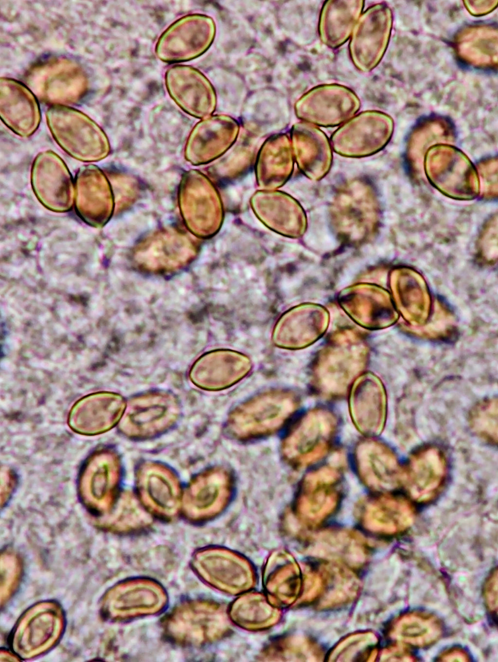 Ps. mescaleroensis Agar Culture